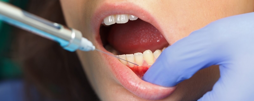 Исследователи выявили главные аллергены в стоматологии