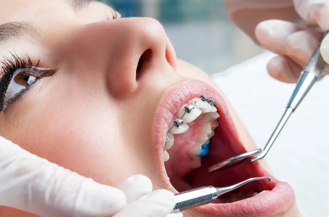 Что лечит ортодонт: какими болезнями занимается этот врач