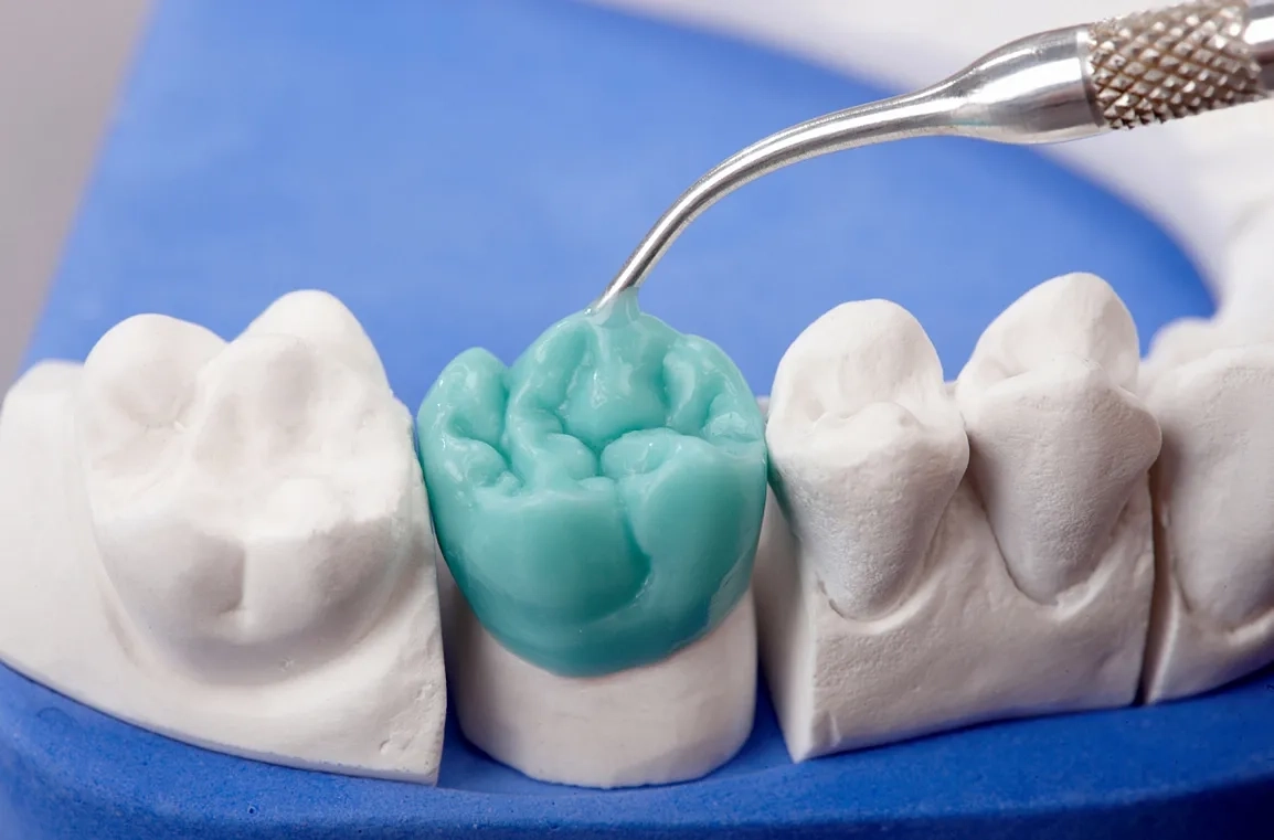 Ученые предлагают альтернативу зубной керамике