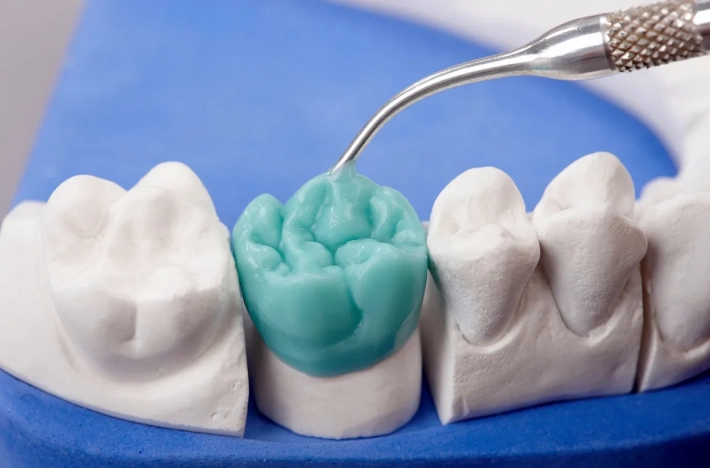 Ученые предлагают альтернативу зубной керамике